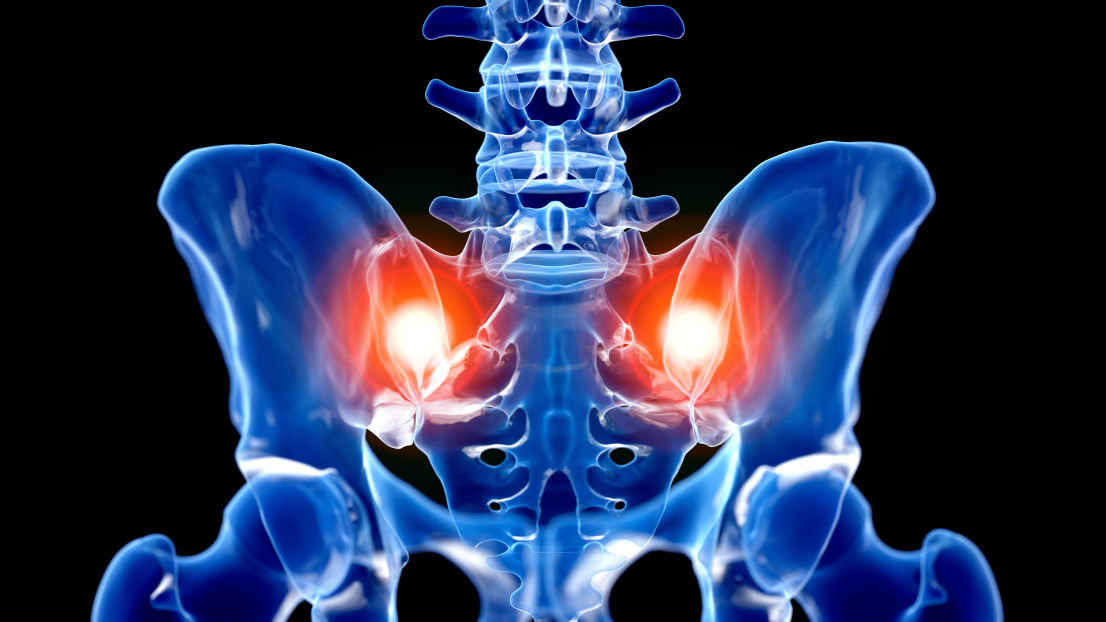 Chronic pain relief, posture, and performance in Chattanooga, TN