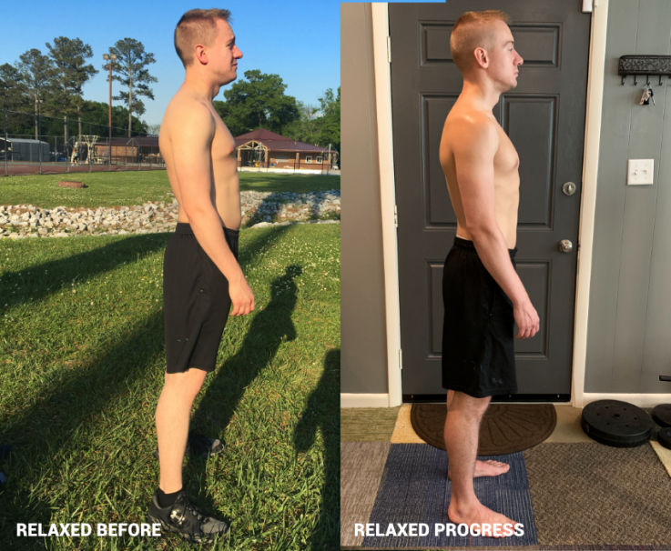 Scoliosis, back pain, neck pain, chronic pain relief, weight lifting injury, hip pain, ex-military, shoulder pain, muscle mass, general fitness, athletic movement - Chattanooga, Ooltewah, Cleveland, Ft Ogelthorpe, Rossville, Knoxville